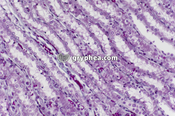 Rein tubules urinaires CL x100 - gryphea.com